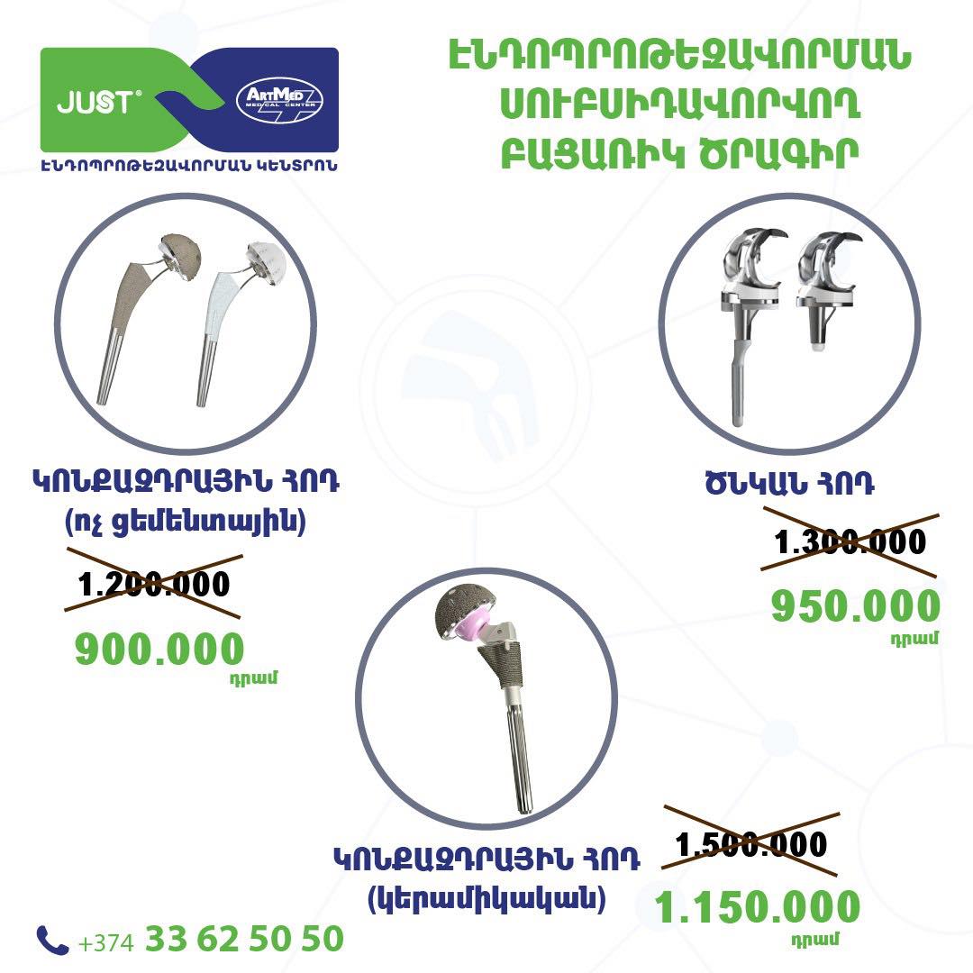 Էնդոպրոթեզավորման սուբսիդավորվող ծրագիր