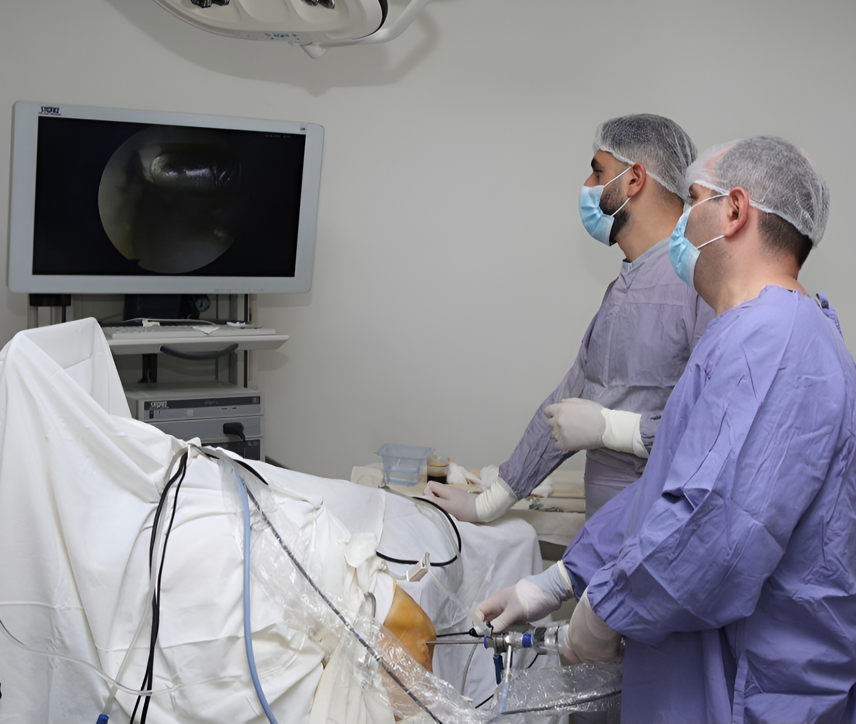 Արթրոսկոպիա